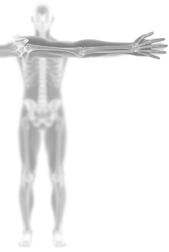 Arm